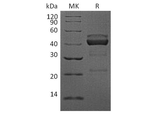 Human TIGIT Recombinant Protein (RPES4644)