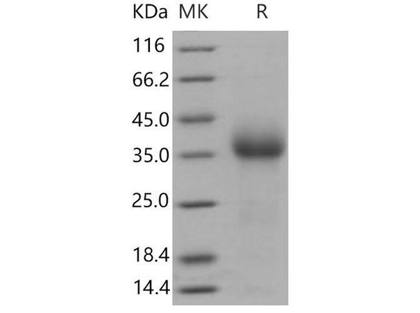 Mouse CD27/TNFRSF7 Recombinant Protein (RPES4650)