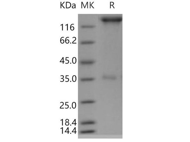 SELP/selectin P/P-selectin Recombinant Protein (RPES4672)