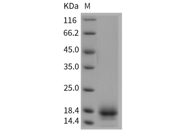 Rat CD59 Recombinant Protein (His Tag) (RPES4690)