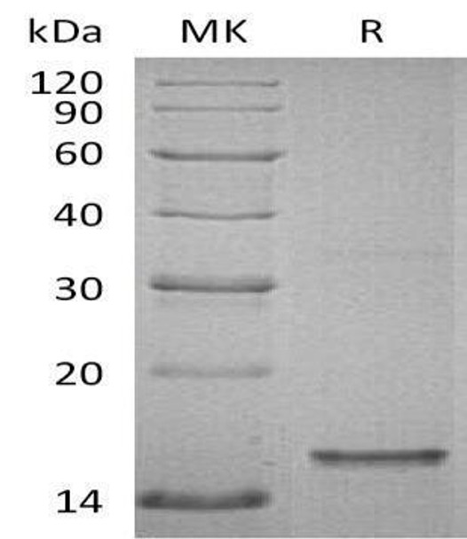 Human Tau-D Recombinant Protein (RPES4697)