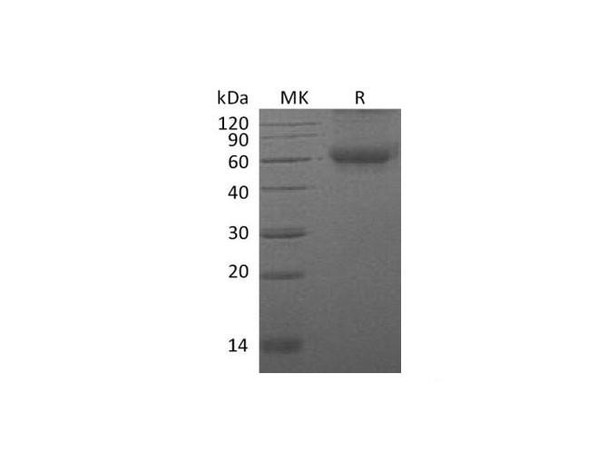 Mouse DDR2 Kinase/CD167b Recombinant Protein (RPES4705)