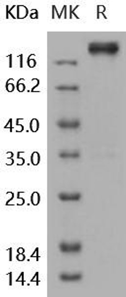 Human LEPR/CD295 Recombinant Protein (RPES4714)