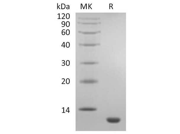 Human CCL11/Eotaxin Recombinant Protein (RPES4715)