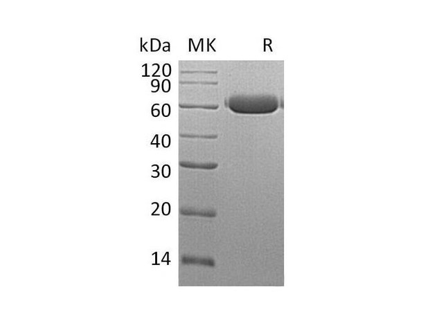 Mouse Legumain/LGMN Recombinant Protein (RPES4726)