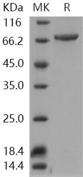 TGM3/Transglutaminase 3 Recombinant Protein (RPES4730)