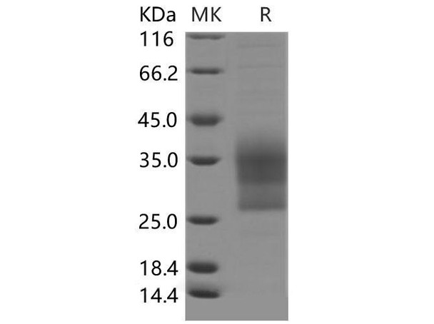 Mouse CD79B/B29 Recombinant Protein (RPES4734)