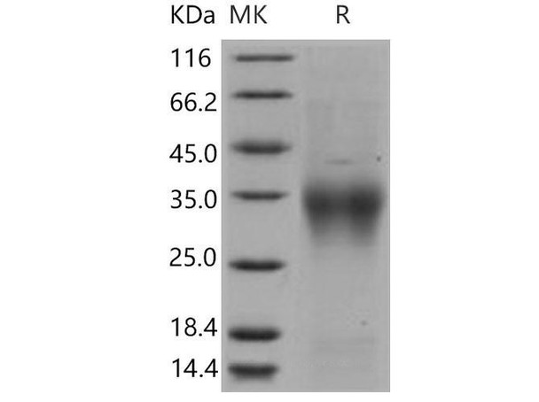 Mouse CD28/TP44 Recombinant Protein (RPES4735)