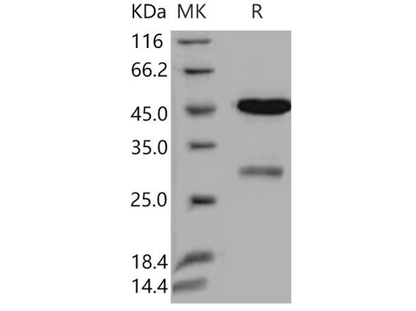 Uracil-DNA glycosylase/UNG Recombinant Protein (RPES4736)
