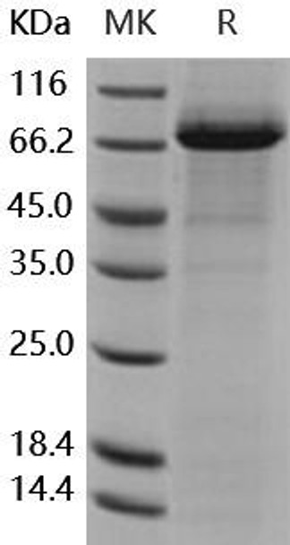 Coagulation Factor XI/F11 Recombinant Protein (RPES4737)