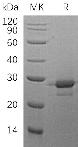 Human MOB1A Recombinant Protein (RPES4740)