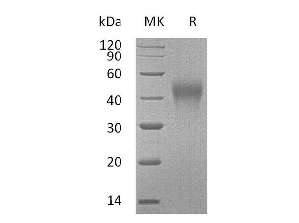 Mouse TIM-3/HAVCR2 Recombinant Protein (RPES4748)