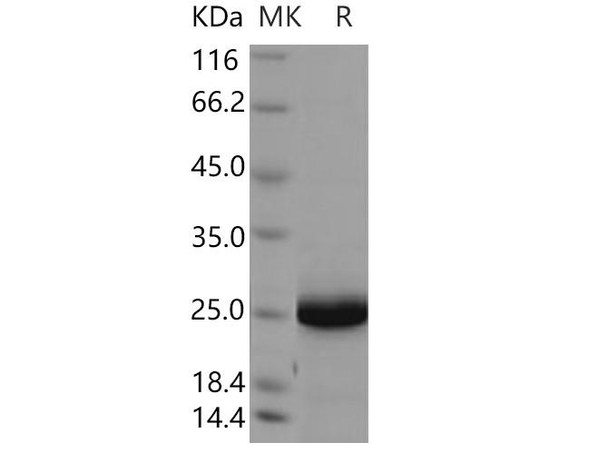 Human UBE2F Recombinant Protein (RPES4758)