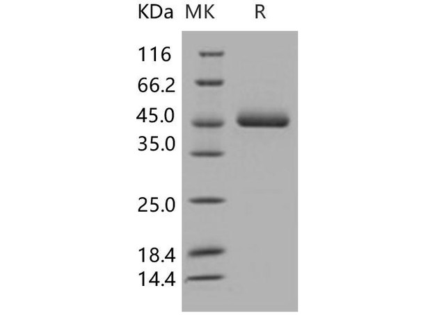Human Renin Recombinant Protein (RPES4775)