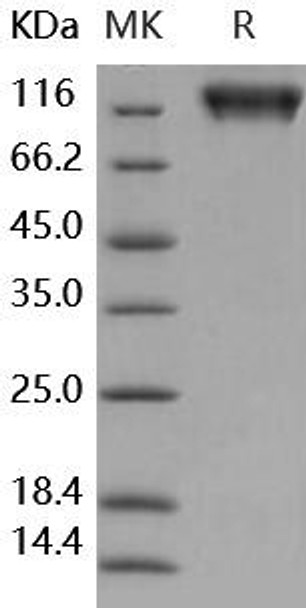 Human MERTK/MER Recombinant Protein (RPES4781)