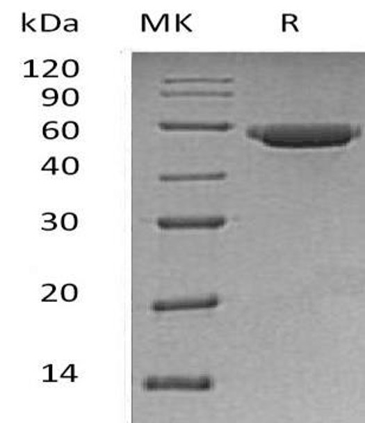 Human Gastric Lipase/LIPF Recombinant Protein (RPES4783)