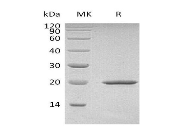 Mouse Sonic Hedgehog/SHH Recombinant Protein  (RPES4791)