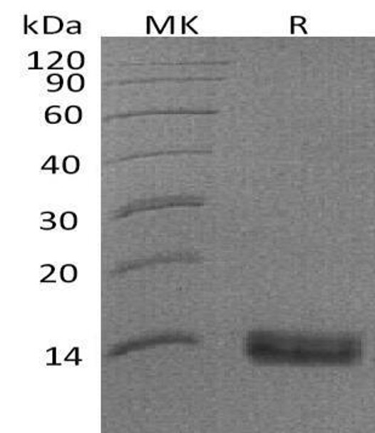 Human SPINK1 Recombinant Protein (RPES4806)