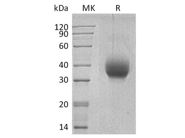 Human SLAMF6/Ly108 Recombinant Protein (RPES4813)