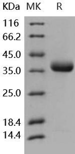 PRLR/Prolactin Receptor Recombinant Protein (RPES4822)