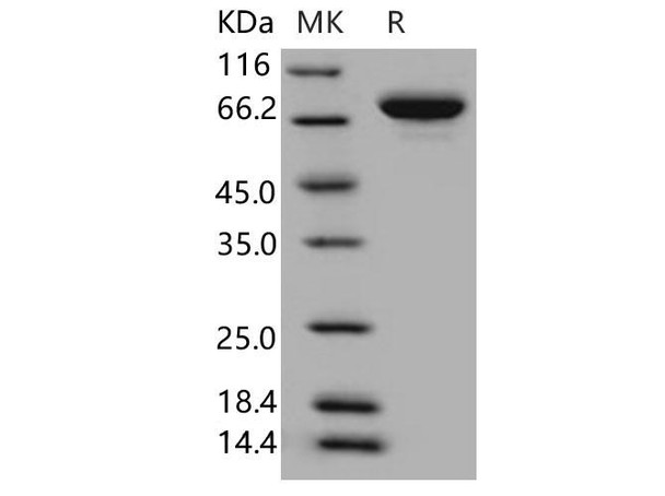 Human XPNPEP2 Recombinant Protein (RPES4835)