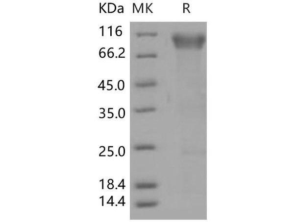 Human BLNK/Ly-57 Recombinant Protein (RPES4841)