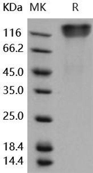 Human OMGP/OMG Recombinant Protein (RPES4842)