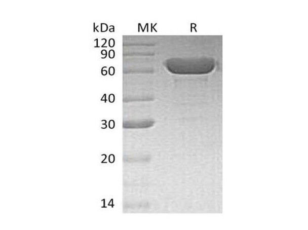 Human Serum Albumin/HSA Recombinant Protein (RPES4846)