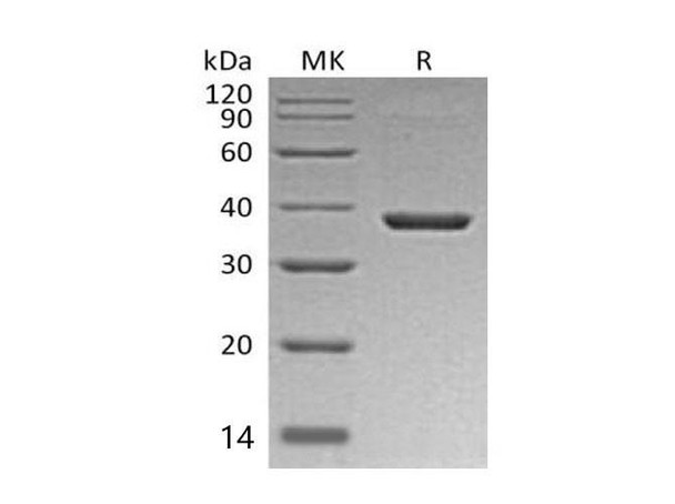Mouse B7-H3/CD276 Recombinant Protein (RPES4848)