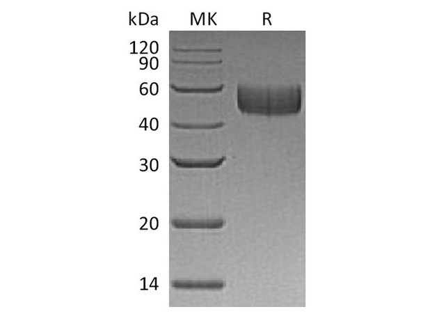 Human SIRPB1/CD172b Recombinant Protein (RPES4853)