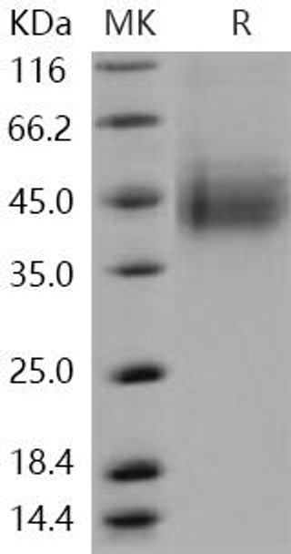 Human CLEC12A/CLL/DCAL2 Recombinant Protein (RPES4856)