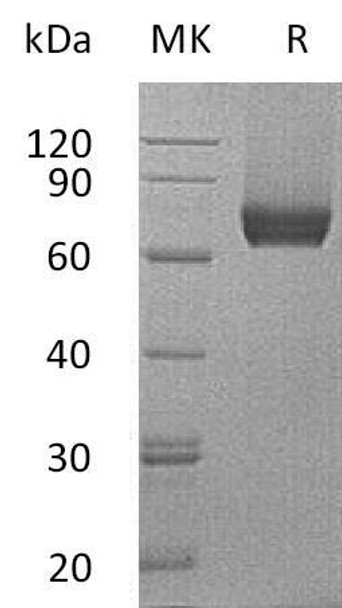 Mouse IL7RA/CD127 Recombinant Protein (RPES4861)