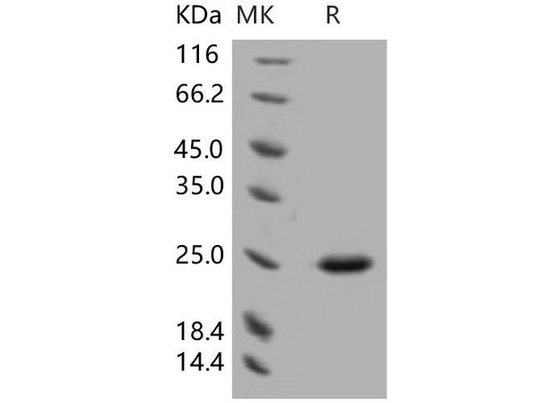 Human SDF2 Recombinant Protein (RPES4878)