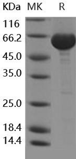 Human LTA4H Recombinant Protein (RPES4879)