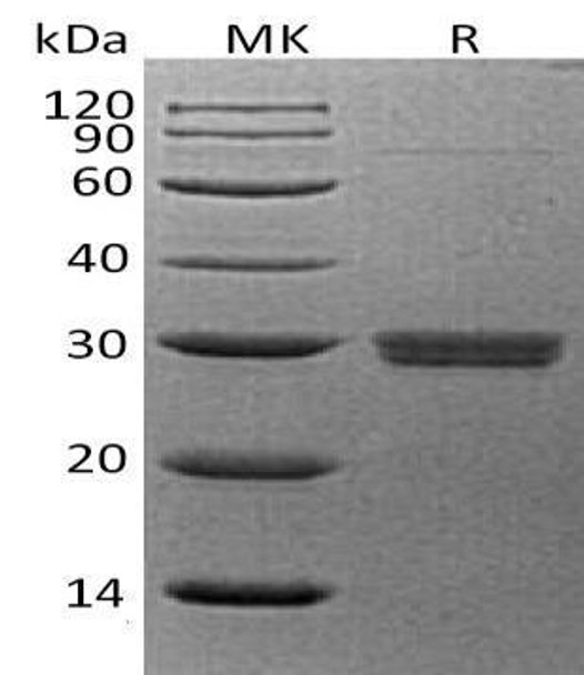 Human APCS/SAP Recombinant Protein (RPES4887)