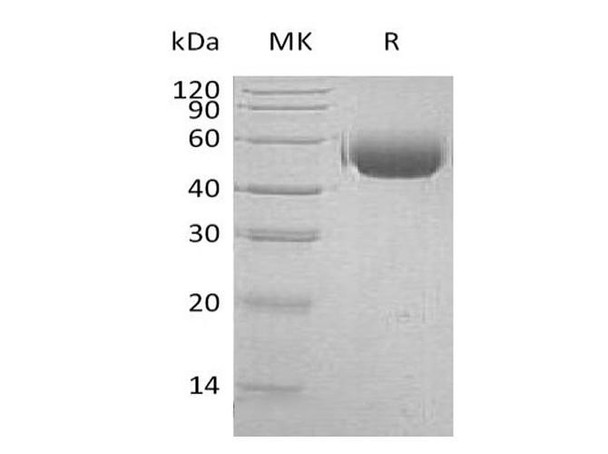 Human CD172a/SIRPA Recombinant Protein (RPES4894)