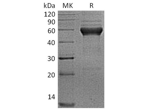 Human ALK/ACVRL1 Recombinant Protein (RPES4895)