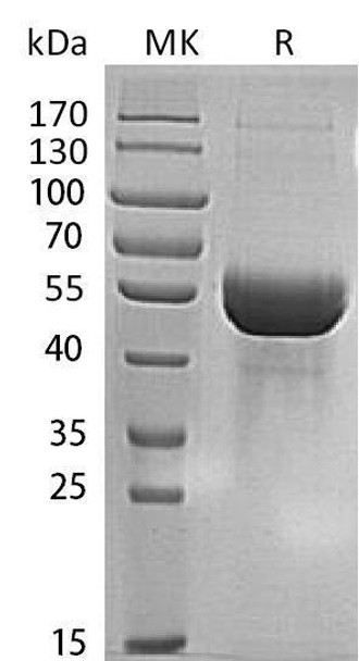 Human MINPP1 Recombinant Protein (RPES4905)