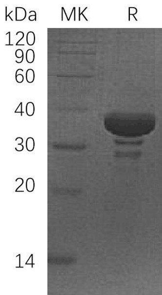 Human SGTA Recombinant Protein (RPES4906)