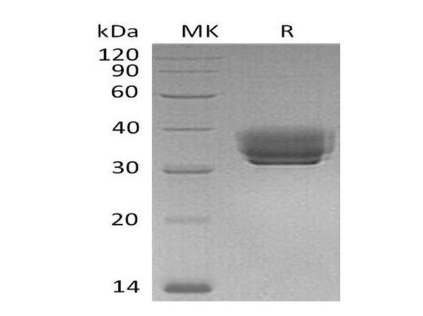 Mouse BTN1A1 Recombinant Protein (RPES4908)