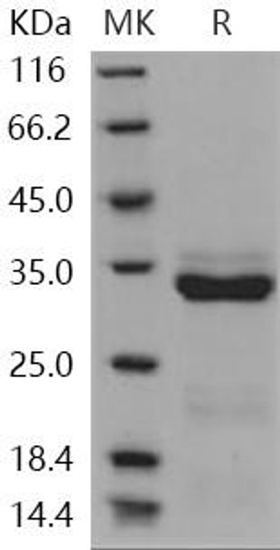 Human Trypsin-3/PRSS3 Recombinant Protein (RPES4916)