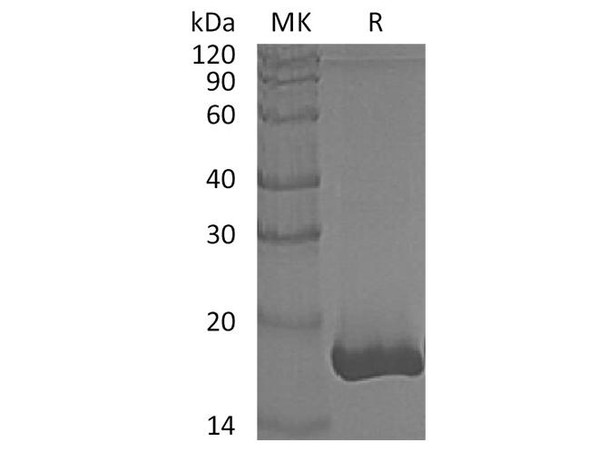 Human GMFB Recombinant Protein (RPES4925)