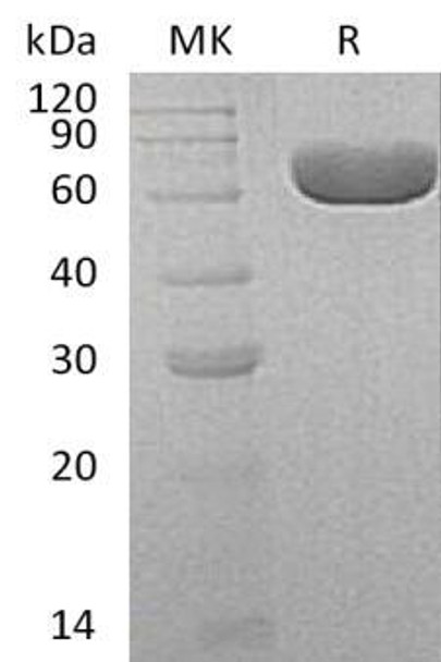 Human SIAE Recombinant Protein (RPES4927)
