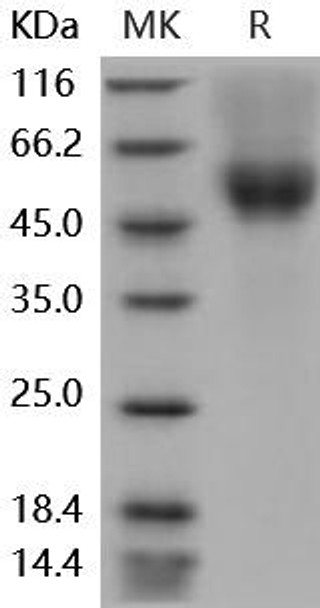 Mouse CD64/FCGR1 Recombinant Protein (RPES4941)