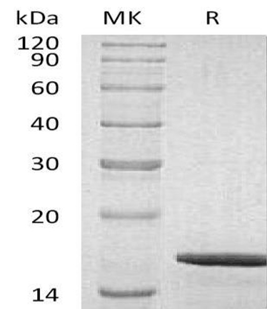 Human GDNF Recombinant Protein  (RPES4945)