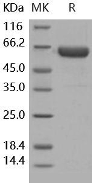 Human Activin RIIA/ACVR2A Recombinant Protein (RPES4964)