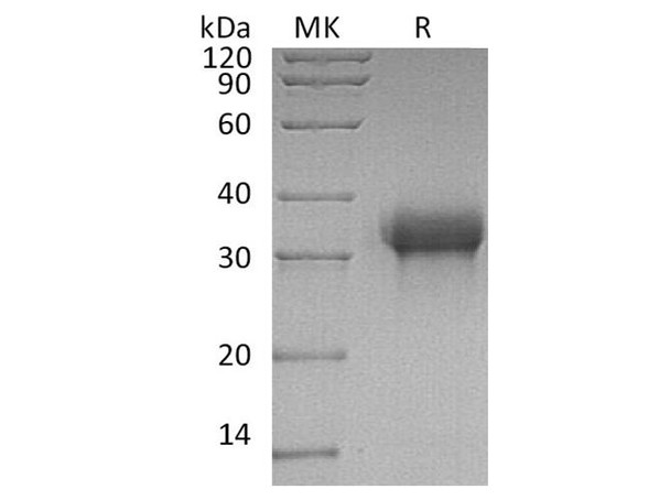 Human SIGLEC15/CD33L3 Recombinant Protein (RPES4975)