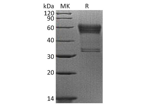 Human 4BB/TNFRSF9 Recombinant Protein (RPES4976)