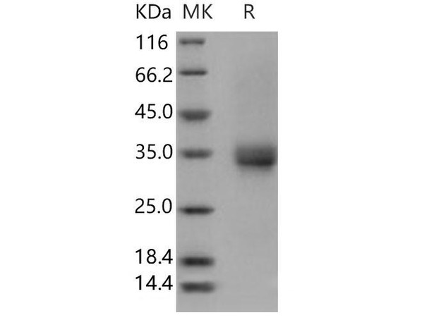 Human CD32b/FCGR2B Recombinant Protein (RPES4980)