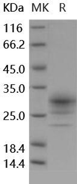 Human CD32b/FCGR2B Recombinant Protein (RPES5001)